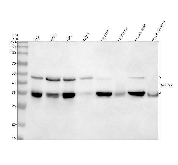 Anti-PIM2 Rabbit Monoclonal Antibody Boster Bio