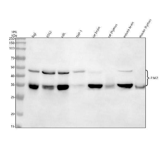 Anti-PIM2 Rabbit Monoclonal Antibody Boster Bio