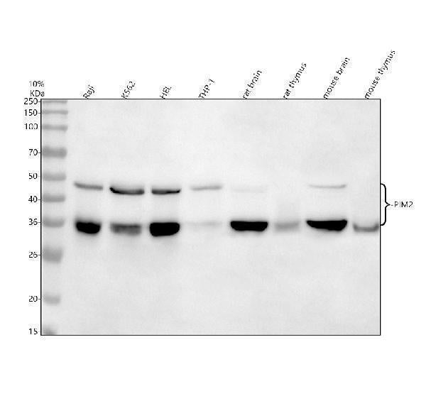 Anti-PIM2 Rabbit Monoclonal Antibody Boster Bio
