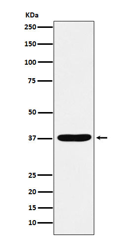 Anti-AKR1C1 / AKR1C2 Rabbit Monoclonal Antibody Boster Bio