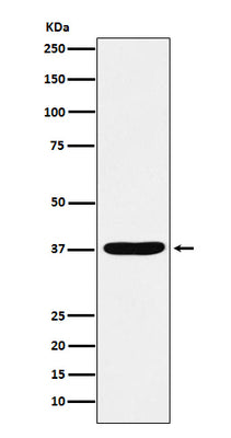 Anti-AKR1C1 / AKR1C2 Rabbit Monoclonal Antibody Boster Bio