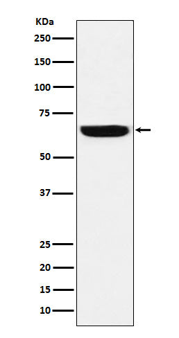 Anti-GBP1 Rabbit Monoclonal Antibody Boster Bio