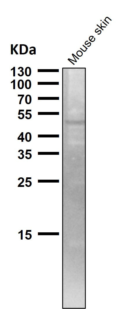 Anti-TRAF4 Rabbit Monoclonal Antibody Boster Bio