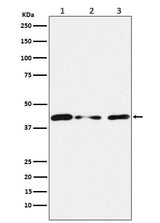 Anti-Tin2 Rabbit Monoclonal Antibody Boster Bio