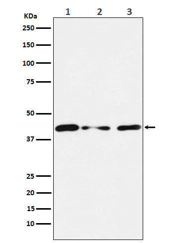 Anti-Tin2 Rabbit Monoclonal Antibody Boster Bio