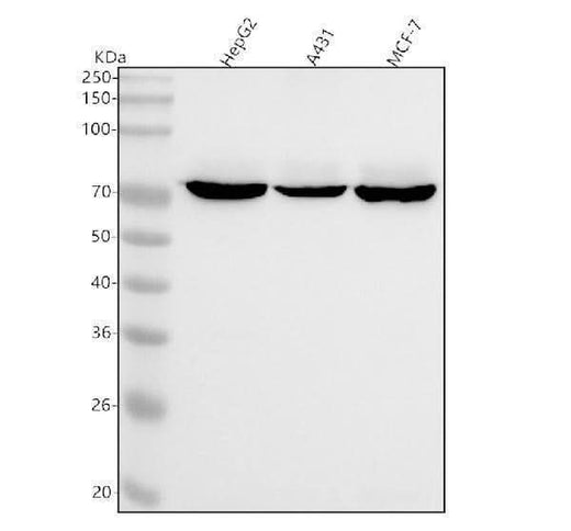 Anti-ZBTB7A Rabbit Monoclonal Antibody Boster Bio
