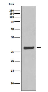 Anti-AQP5 Rabbit Monoclonal Antibody Boster Bio