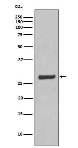 Anti-AQP5 Rabbit Monoclonal Antibody Boster Bio