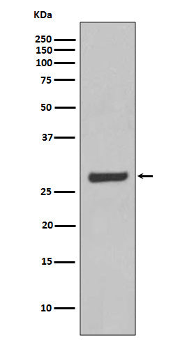 Anti-AQP5 Rabbit Monoclonal Antibody Boster Bio
