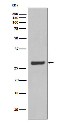 Anti-AQP5 Rabbit Monoclonal Antibody Boster Bio