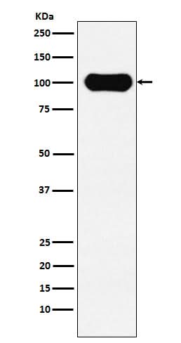 Anti-FE65 Rabbit Monoclonal Antibody Boster Bio