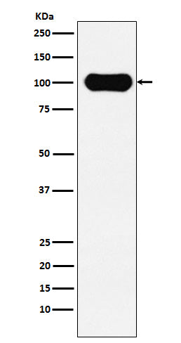 Anti-FE65 Rabbit Monoclonal Antibody Boster Bio