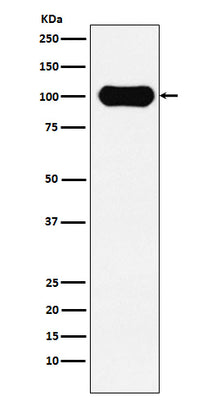 Anti-FE65 Rabbit Monoclonal Antibody Boster Bio