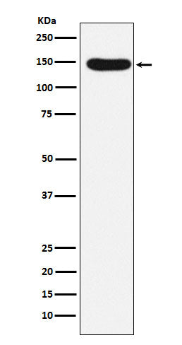 Anti-Desmoglein 3 Rabbit Monoclonal Antibody Boster Bio
