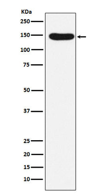 Anti-Desmoglein 3 Rabbit Monoclonal Antibody Boster Bio