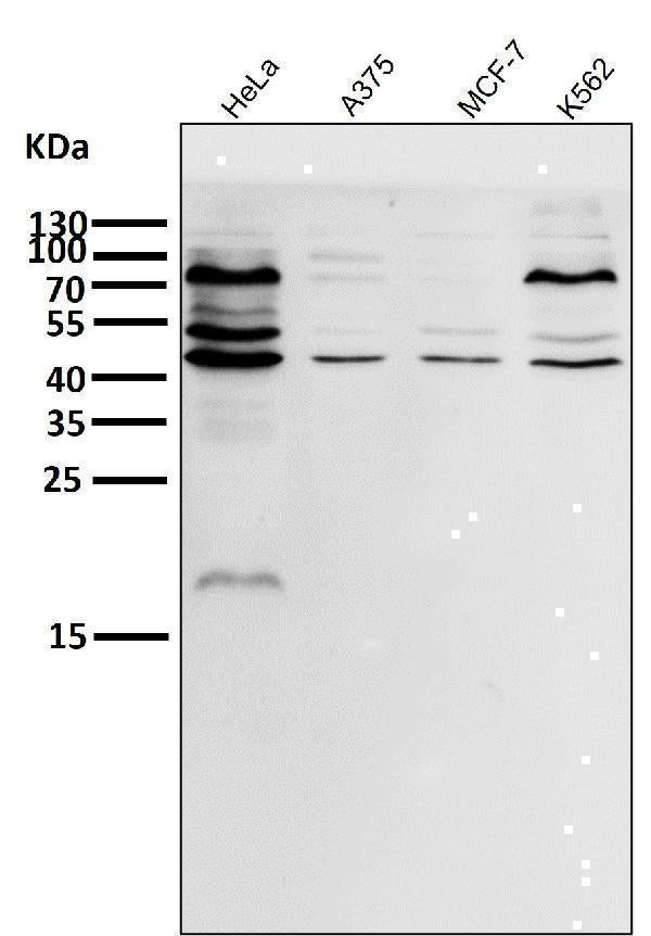 Anti-eIF4A3 Rabbit Monoclonal Antibody Boster Bio