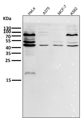 Anti-eIF4A3 Rabbit Monoclonal Antibody Boster Bio