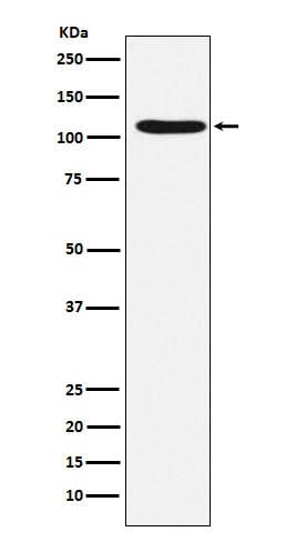 Anti-HIRA Rabbit Monoclonal Antibody Boster Bio
