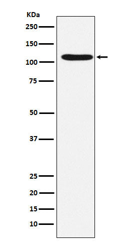 Anti-HIRA Rabbit Monoclonal Antibody Boster Bio