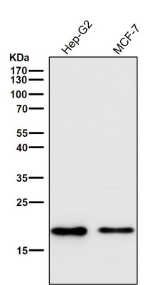 Anti-Cripto1 Rabbit Monoclonal Antibody Boster Bio