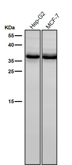 Anti-BNIP3L/Nix Rabbit Monoclonal Antibody Boster Bio