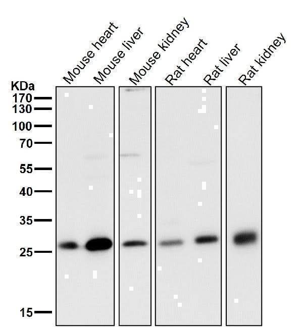 Anti-NQO2 Rabbit Monoclonal Antibody Boster Bio