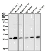 Anti-NQO2 Rabbit Monoclonal Antibody Boster Bio