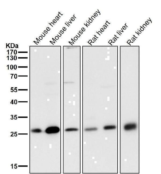 Anti-NQO2 Rabbit Monoclonal Antibody Boster Bio