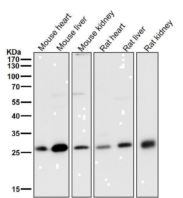 Anti-NQO2 Rabbit Monoclonal Antibody Boster Bio