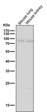 Anti-BDKRB2 Monoclonal Antibody Boster Bio
