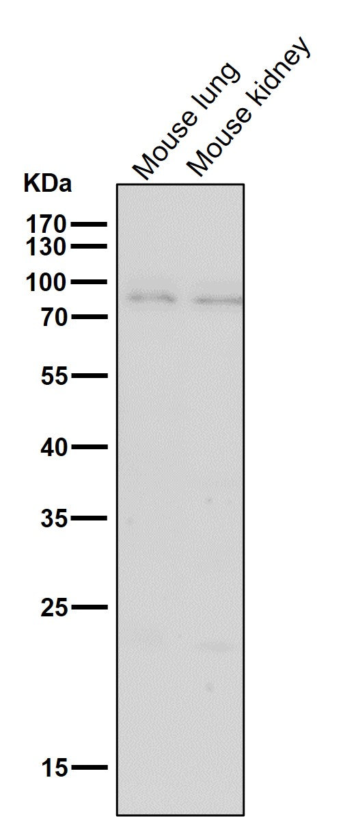 Anti-BDKRB2 Monoclonal Antibody Boster Bio