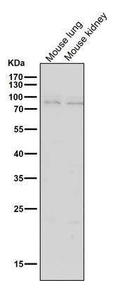 Anti-BDKRB2 Monoclonal Antibody Boster Bio