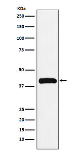 Anti-Bub3 Rabbit Monoclonal Antibody Boster Bio