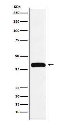 Anti-Bub3 Rabbit Monoclonal Antibody Boster Bio