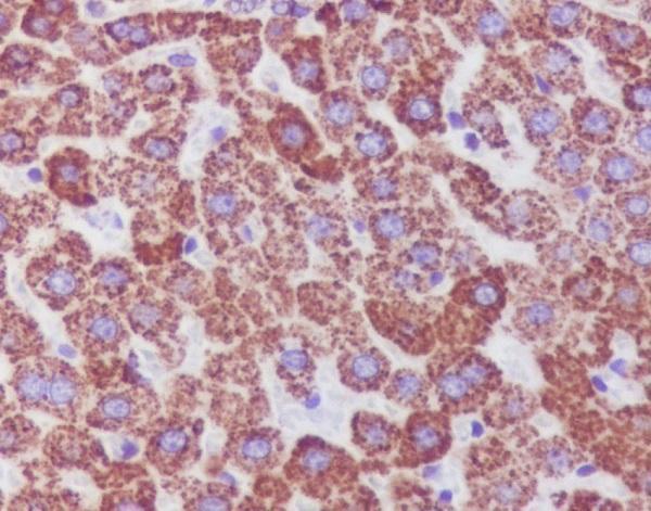 Anti-Catalase Rabbit Monoclonal Antibody Boster Bio
