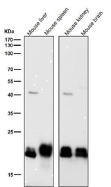 Anti-SRSF3 Rabbit Monoclonal Antibody Boster Bio