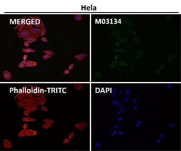 Anti-Clathrin heavy chain Rabbit Monoclonal Antibody Boster Bio