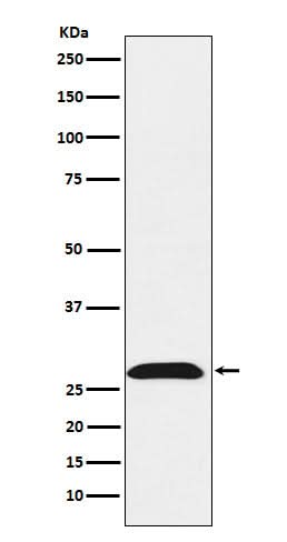 Anti-RhoGDI Rabbit Monoclonal Antibody Boster Bio