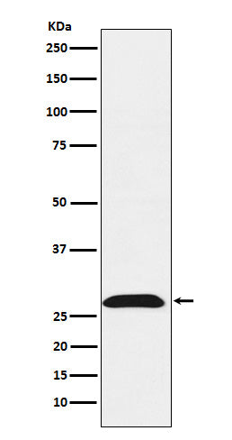 Anti-RhoGDI Rabbit Monoclonal Antibody Boster Bio