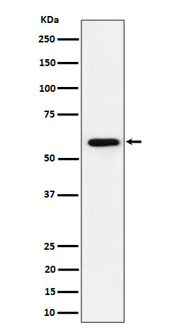 Anti-PRPF31 Rabbit Monoclonal Antibody Boster Bio