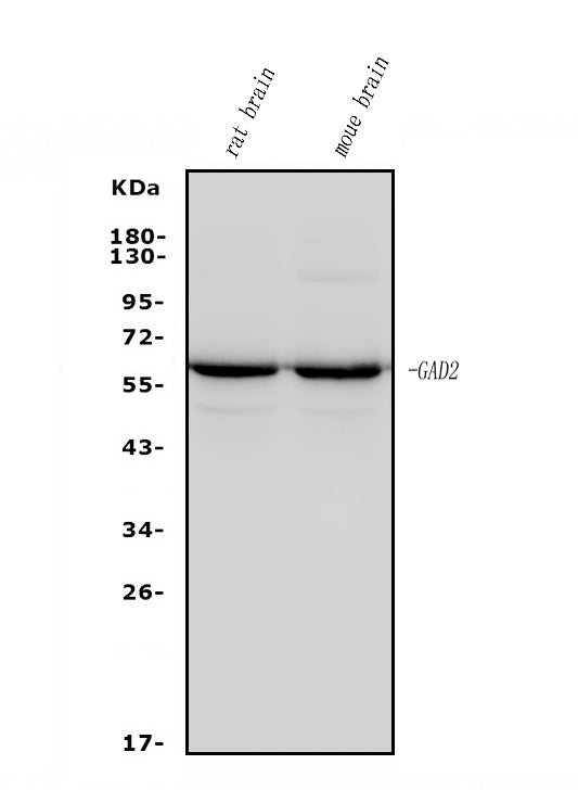 Anti-GAD65/GAD2 Antibody Picoband® (monoclonal, 4E12 Boster Bio