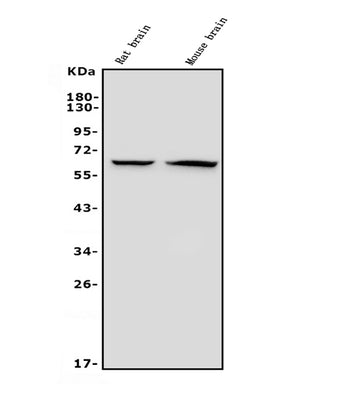 Anti-GAD65/GAD2 Antibody Picoband® (monoclonal, 7G2 Boster Bio