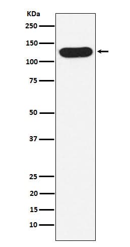 Anti-Nicastrin Rabbit Monoclonal Antibody Boster Bio