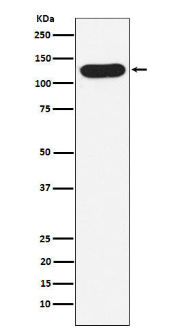 Anti-Nicastrin Rabbit Monoclonal Antibody Boster Bio