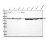 Anti-SFRP4 Rabbit Monoclonal Antibody Boster Bio