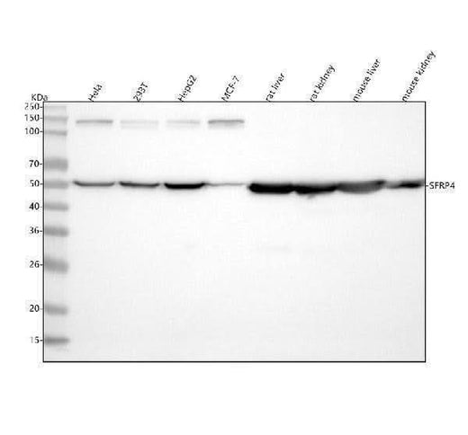 Anti-SFRP4 Rabbit Monoclonal Antibody Boster Bio