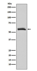 Anti-Muscarinic Acetylcholine Receptor M3 Rabbit Monoclonal Antibody Boster Bio