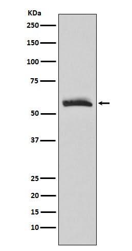 Anti-Muscarinic Acetylcholine Receptor M3 Rabbit Monoclonal Antibody Boster Bio