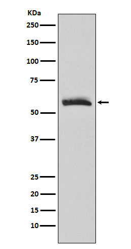 Anti-Muscarinic Acetylcholine Receptor M3 Rabbit Monoclonal Antibody Boster Bio