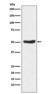 Anti-GSK3 alpha Rabbit Monoclonal Antibody Boster Bio